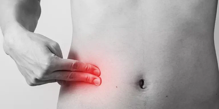 عمل آپاندیس