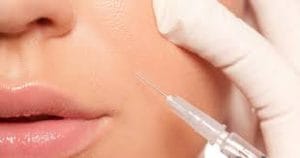 تزریق چربی به خط خنده
