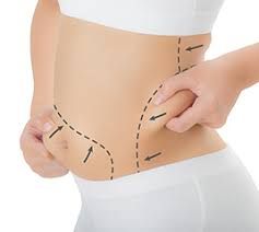 تفاوت ابدومینوپلاستی و لیپوساکشن